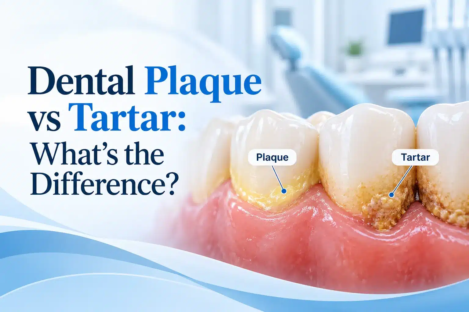 Illustration comparing dental plaque and tartar buildup on teeth, showing the difference between soft plaque and hardened tartar near the gumline.